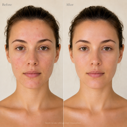 Mirelle Even Serum